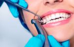 Как проводится чистка зубов в стоматологии?