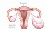 Особенности и проявления кистомы яичника