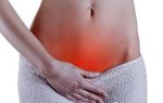 Зачатие и беременность при воспалении яичников