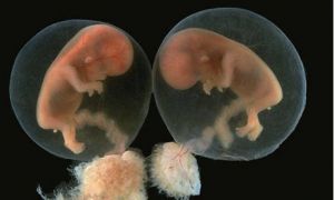 Являются ли два желтых тела в яичниках признаком многоплодной беременности