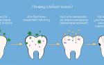 Введение в проблему зубов и возможные причины ее возникновения