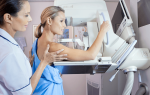 Как работает маммограф?