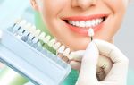 Эстетическая стоматологическая клиника: какую выбрать?