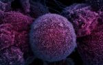 Лечение раковых образований на яичнике код мкб 10