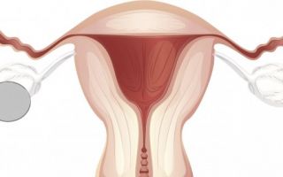 Виды и особенности развития гормонопродуцирующих образований яичников