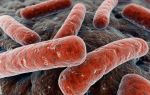 Развитие и лечение разных видов генитального туберкулеза