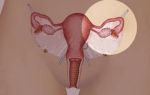 Что такое атрофия яичника у женщины и как лечить эту болезнь