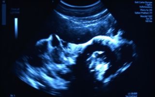 УЗИ в Екатеринбурге: какие исследования стоит сделать при болях в спине и суставах, и как подготовиться, чтобы получить точные данные